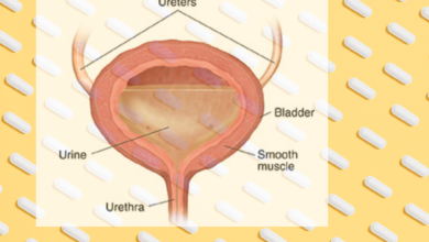 التهاب المثانة بعد الجماع