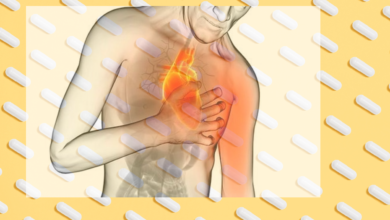 النوبة القلبية - احتشاء عضلة القلب